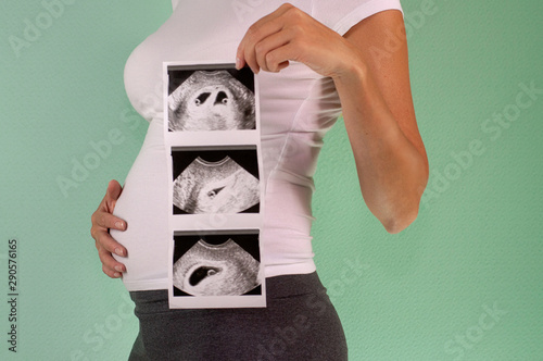 The girl is holding a snapshot of an ultrasound twin in the fourth week of pregnancy. First trimester. Confirmation of pregnancy.