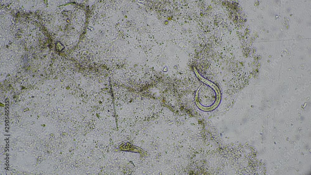 Video Stock Strongyloides stercoralis larva in stool exam.Parasite in