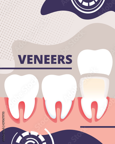 Dental Veneers Aid Banner, Infographics Poster