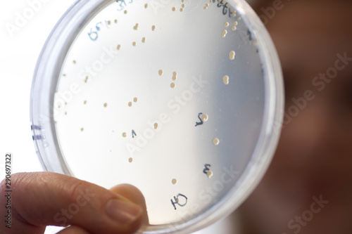 Pilzkulturen in einer Petrischale in einem Biotech Unternehmen photo