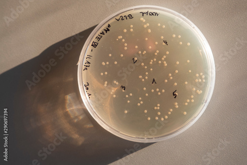 Labor Petrischale mit Kulturen von Bakterien