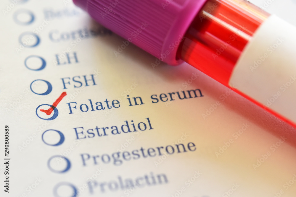 Obraz premium Blood sample tube with laboratory requisition form for folate test