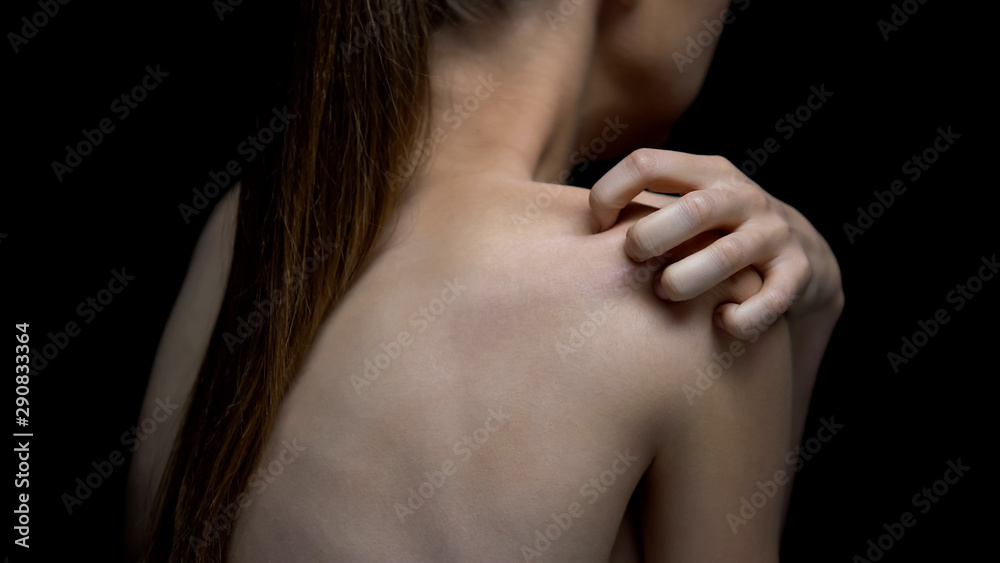 Hysterical naked female victim scratching back, psychological problem, ptsd