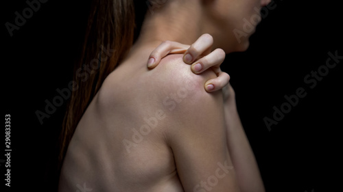Foto Female suffering anorexia scratching shoulder, psychological problem, disorder