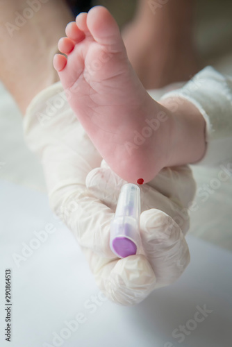 nurse performing the neonatal heel prick test