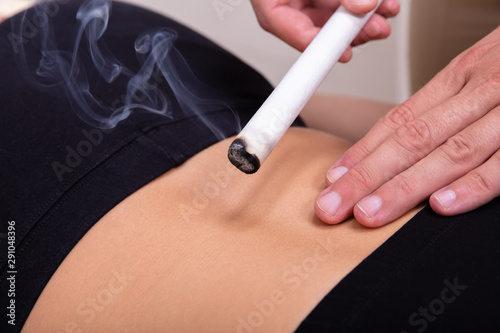 Moxibustion Procedure At Health Center