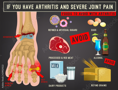 Arthritis foods image