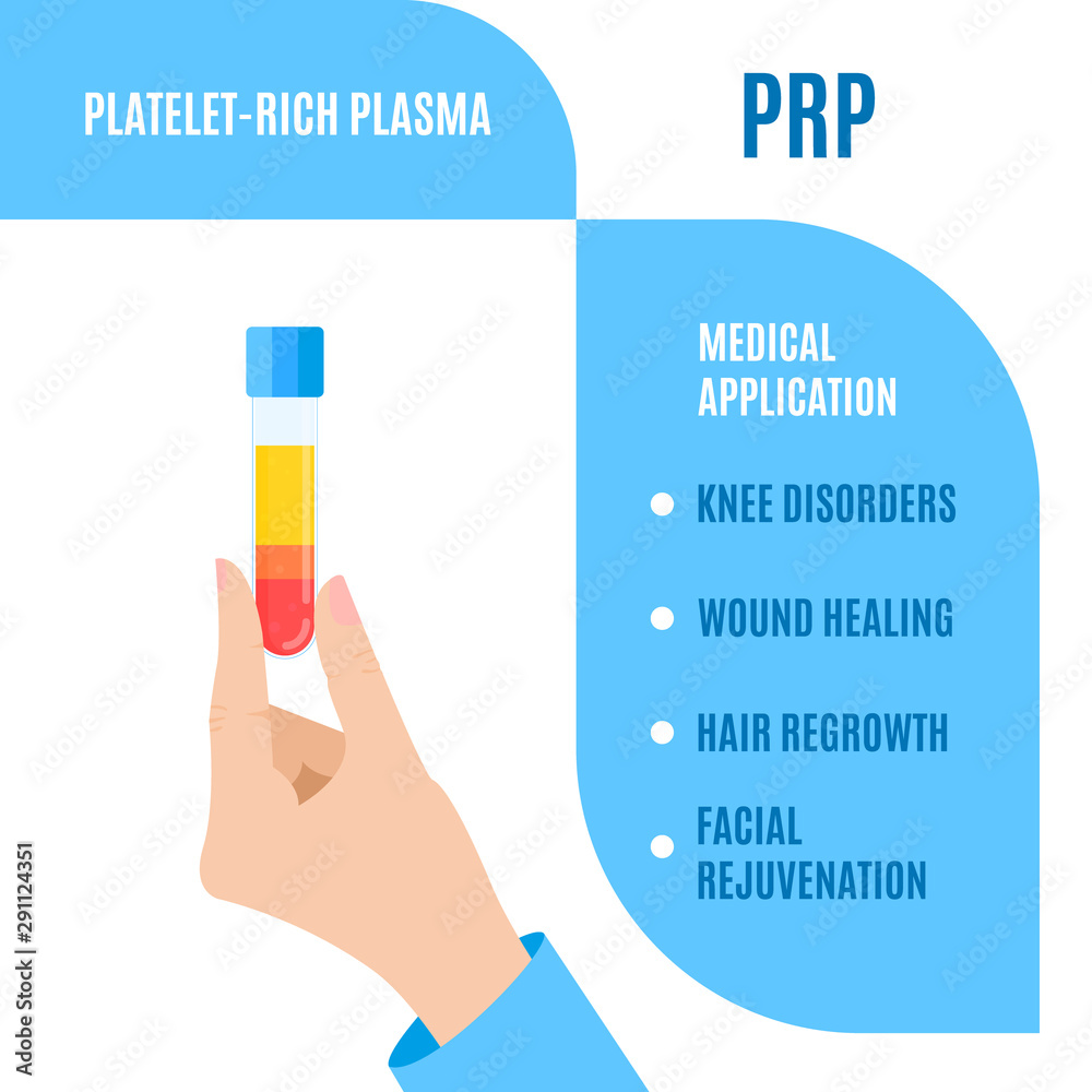 Doctor holding a test tube with blood for platelet rich plasma