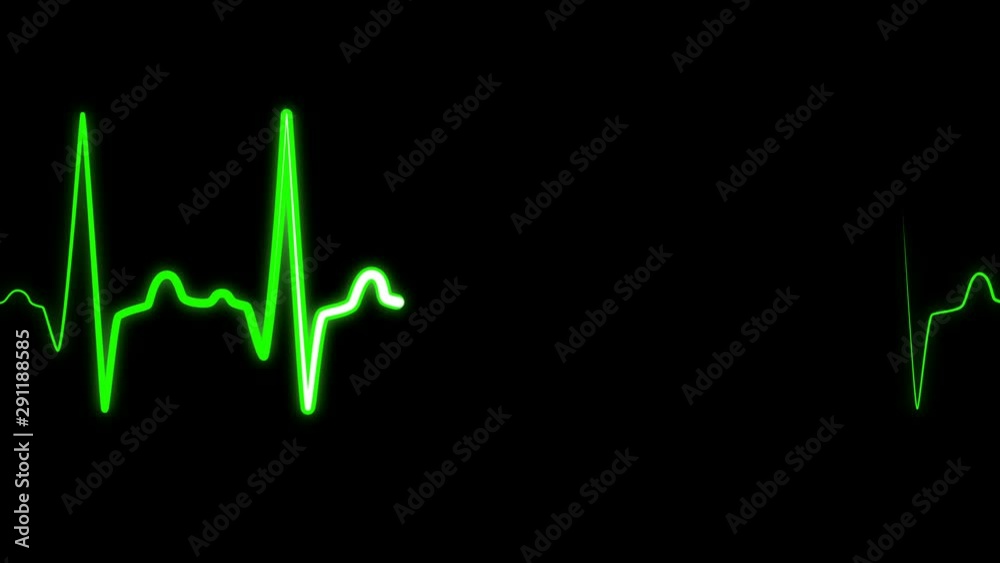 EKG ECG heart rate chart, a medical screen of healthy heart rate