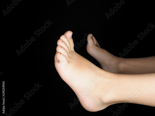 Feet of caucasian child in hand of dertmatologist doctor isolated towards black