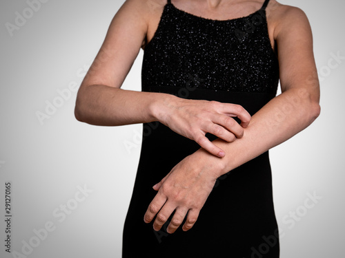 Woman scratching itchy skin on hands. Health and beauty concepts