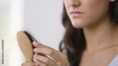 Woman with hair loss photo