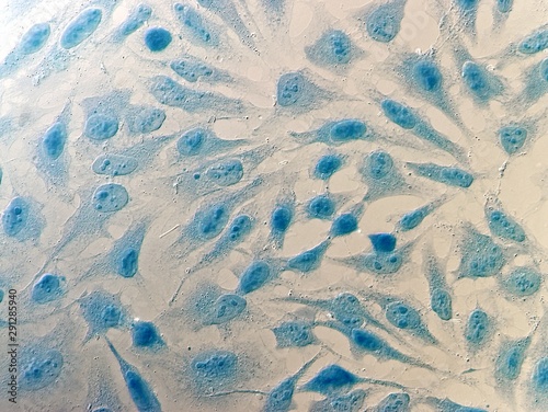 HeLa cervical cancer cells