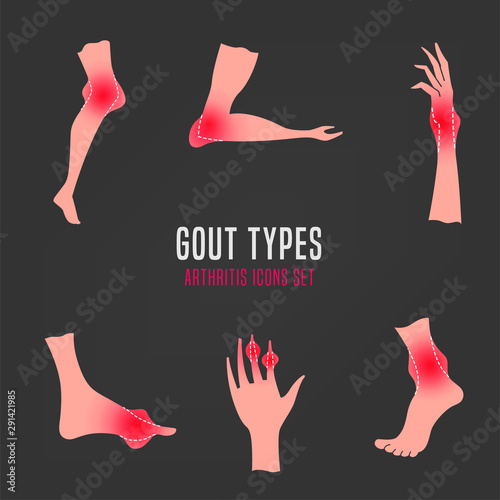 Gout arthritis icon