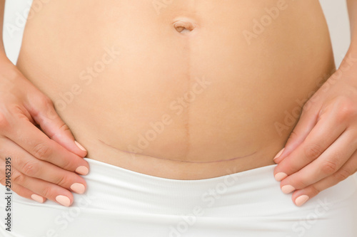 Obraz na plátně Woman naked belly