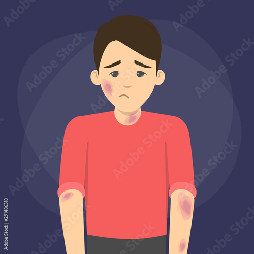 Man with bruises on the skin. Health injury, bruised guy