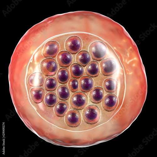 The malaria-infected red blood cell. 3D illustration showing malaria parasite Plasmodium falciparum in schizont stage inside red blood cell, the causative agent of tropical malaria