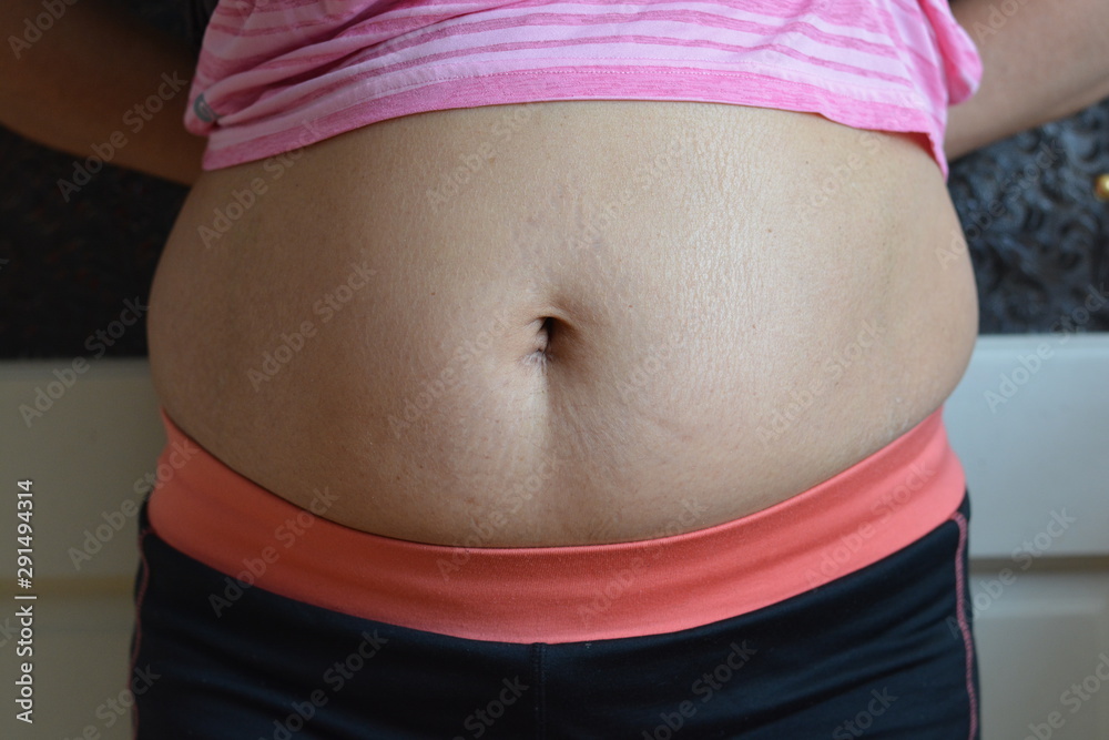 How To Reduce A Piercing Scar Around The Belly Button? - Psycho Tats
