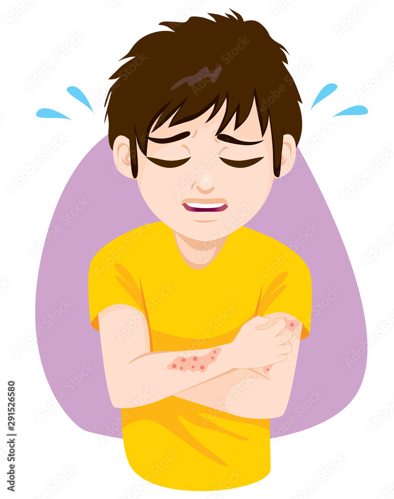 Young teenager man scratching itchy skin allergy health problem Young teenager man scratching itchy skin allergy health problem