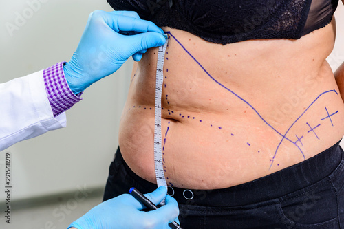 The doctor drawing lines on the patient’s skin