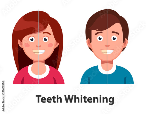 Man and woman before and after teeth whitening
