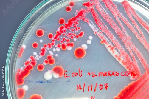 red colony of bacteria in mircobiology laboratory