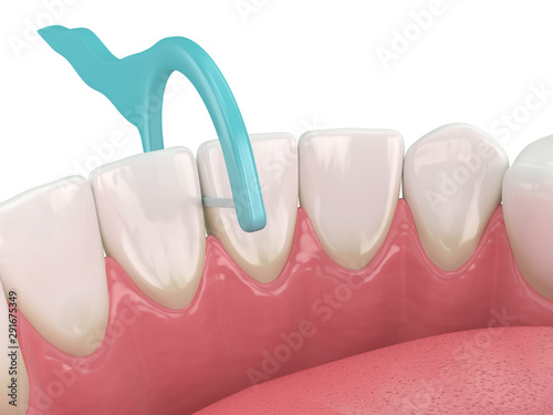 3d render of jaw with dental floss toothpick