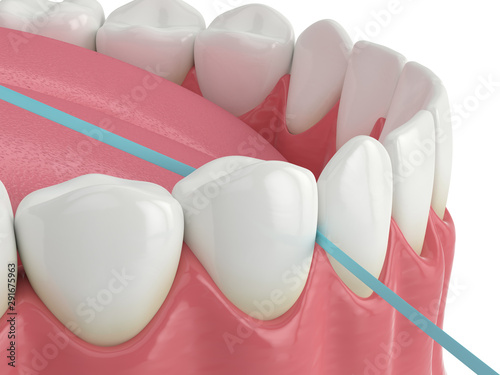 Obraz na plátně 3d render of jaw with dental floss