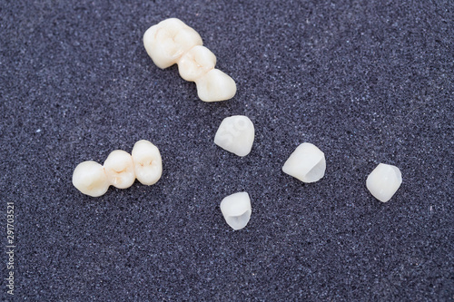 ceramic crowns of human teeth closeup macro isolate on black background.
