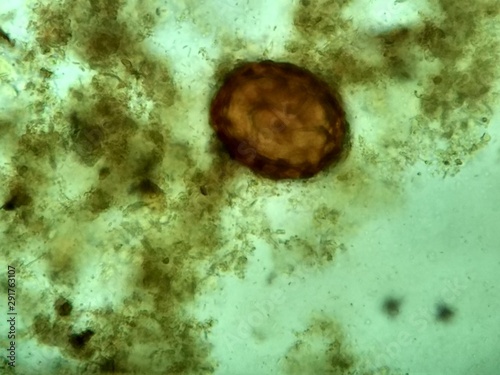 Huevo de Sacarosa lumbricoides 400x Fresco photo