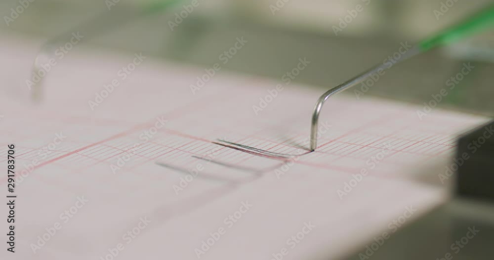 A macro of the activity of a lie detector machine in use.