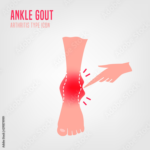 Gout arthritis icon