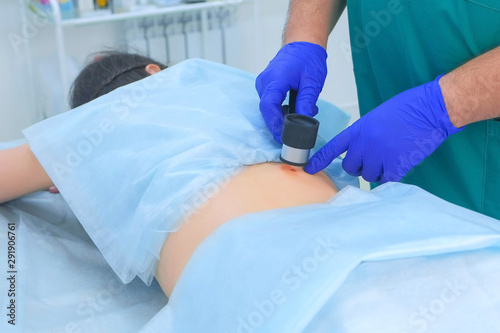 Surgeon examines mole using dermatoscope magnifier before laser removing on patient woman back in clinic, hands closeup. Cancer risk prediction concept. One day surgery cosmetic treatment.