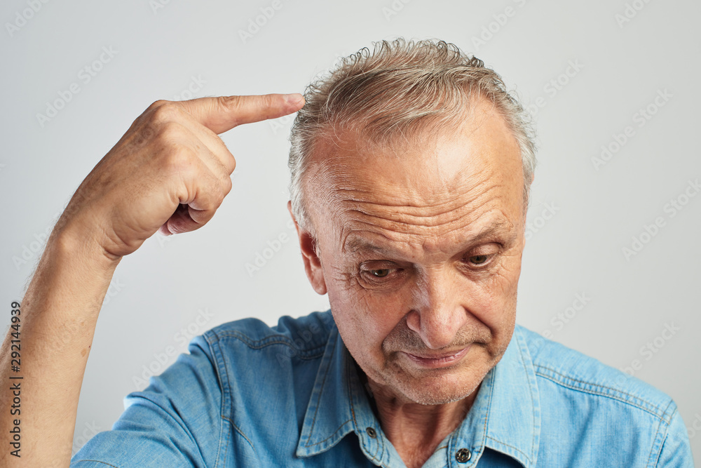 Hair problems. Pensioner points a finger at gray hair. The old man is balding. On a white background in a blue shirt Hair problems. Pensioner points a finger at gray hair. The old man is balding. On a white background in a blue shirt