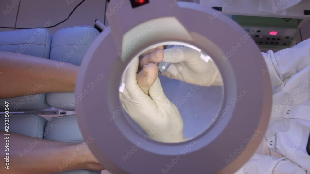 Podology.Podologist works with a female sole.The view through the cosmetology magnifying glass.Hardware pedicure.Close-up Podology.Podologist works with a female sole.The view through the cosmetology magnifying glass.Hardware pedicure.Close-up