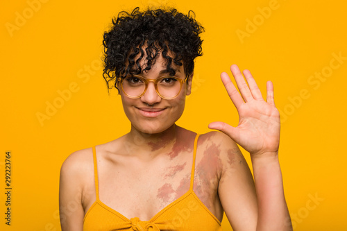 Young african american woman with skin birth mark smiling cheerful showing number five with fingers.