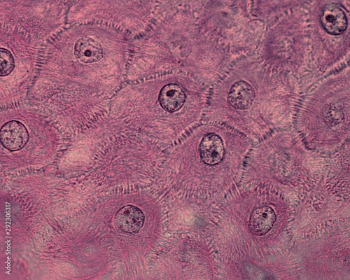 Epidermis. Spinous cell layer photo