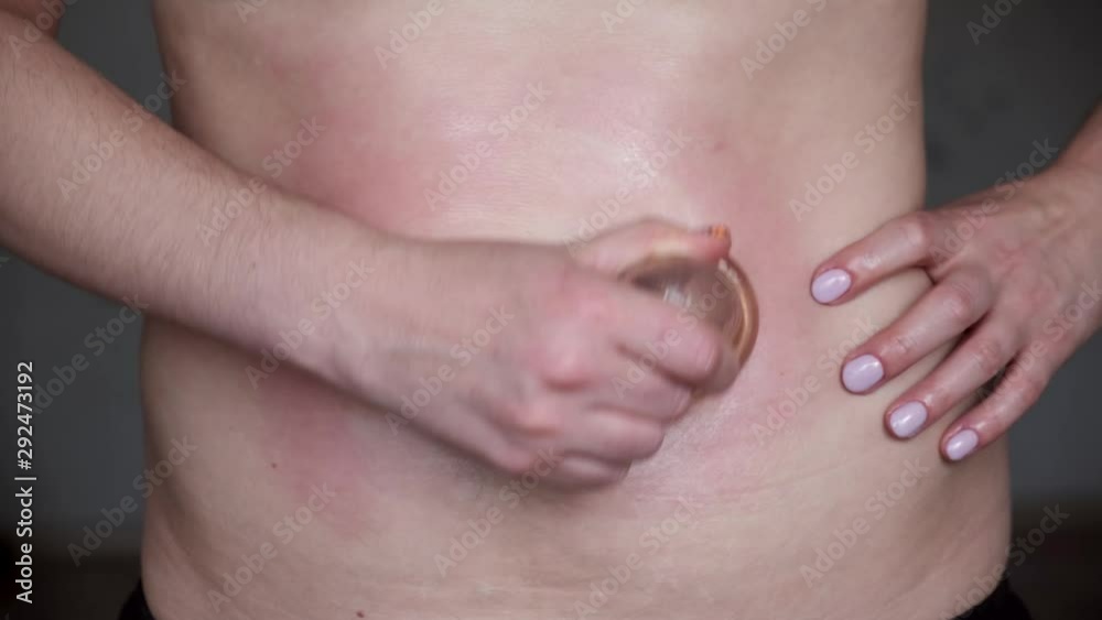 woman doing anti-cellulite vacuum massage therapy on her belly, self-massage in home woman doing anti-cellulite vacuum massage therapy on her belly, self-massage in home