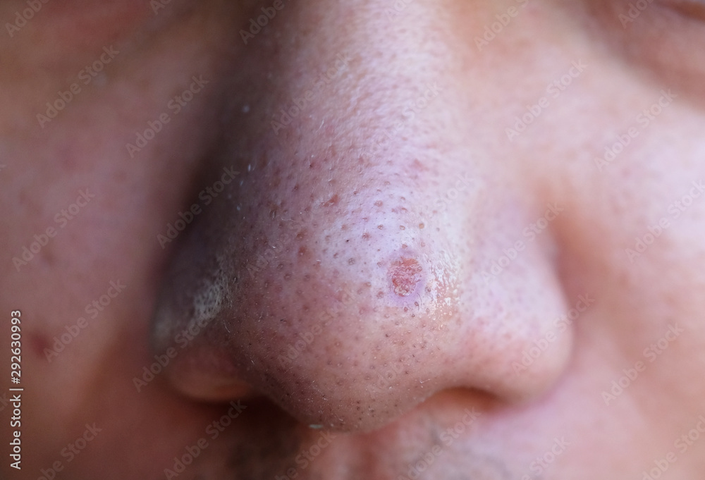 close up of a face close up of a face