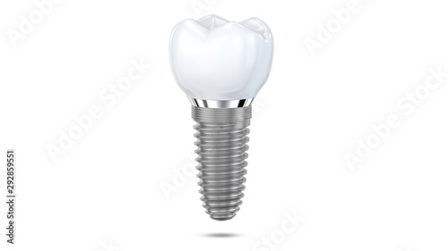 Dental implant model of molar tooth levitate at the air as a concept of implantation teeth and dental surgery. 3d rendering illustration isolated on white background.