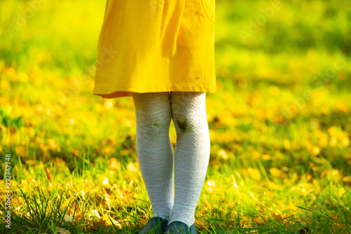 Little girl in a yellow dress and white stockings after falling to the ground. Stains of dirt on your knees. Autumn day. Dirty knees, baby.