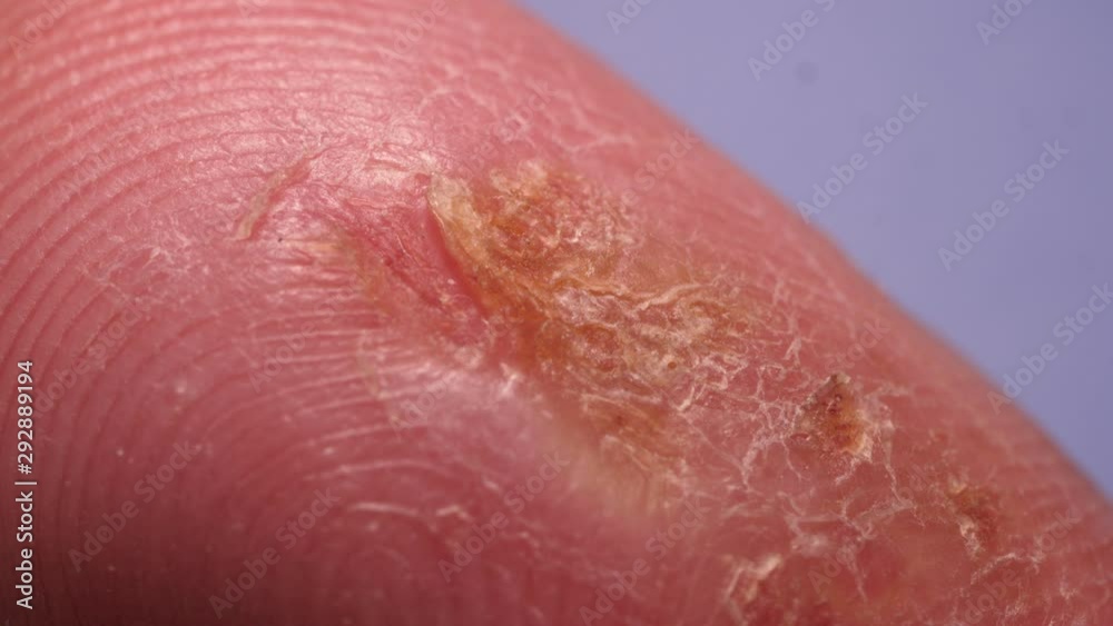 Close up of Human Skin Texture Close up of Human Skin Texture
