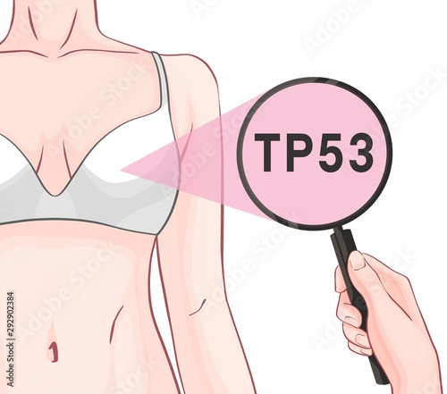 Variants in the TP53 gene are associated with an increased risk of developing breast cancer photo