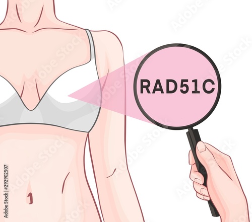 Variants in the RAD51C gene are associated with an increased risk of developing breast cancer