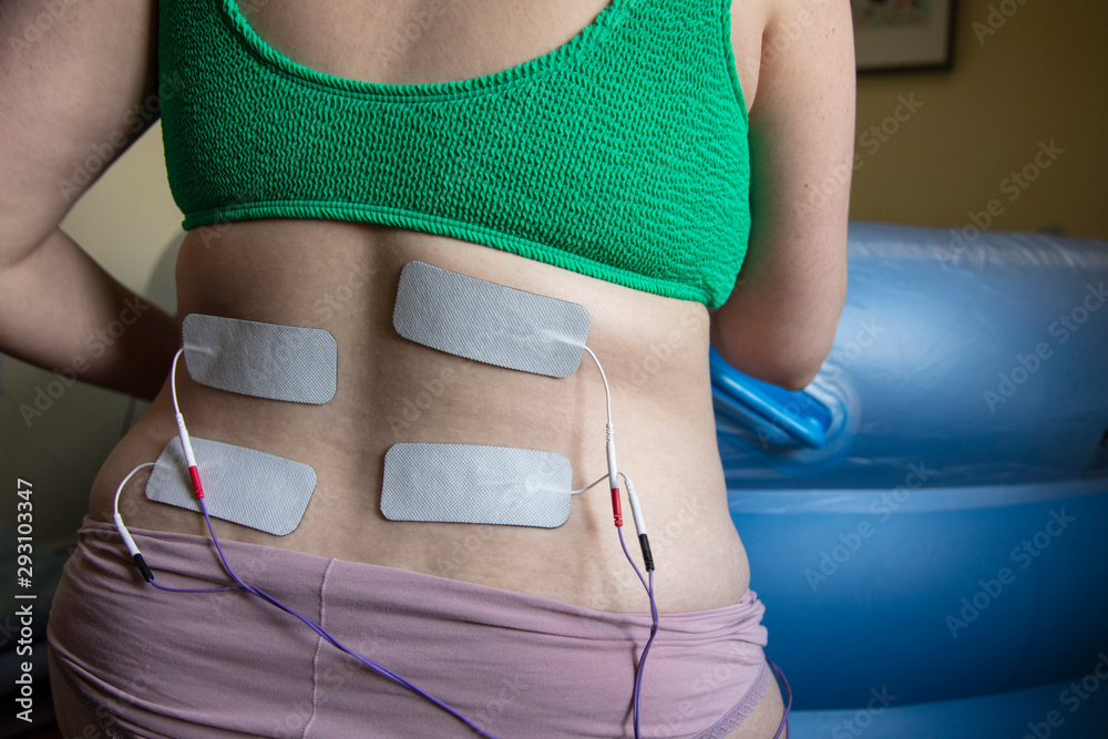 A pregnant woman in labour wearing a tens machine as pain relief Stock