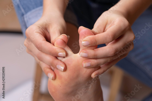 A closeup view on the caucasian foot of a young lady  using her hands to part the toes and take a closer look in between  checking for dirt and hygiene.