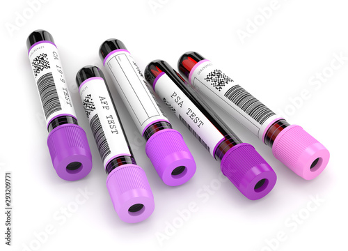 3d render of  blood samples with tumor markers test photo