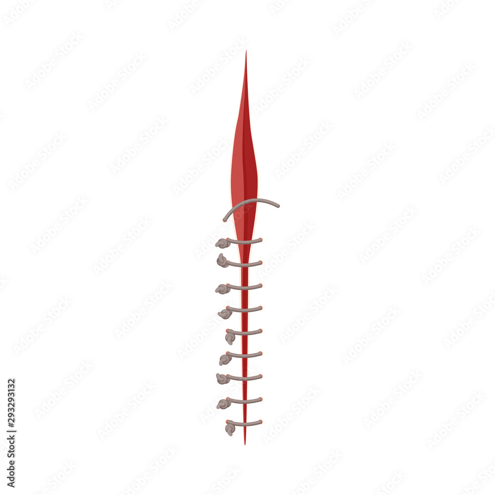 Vector Illustration Of Suture For Wound Isolated On White Background Vector Illustration Of Suture For Wound Isolated On White Background