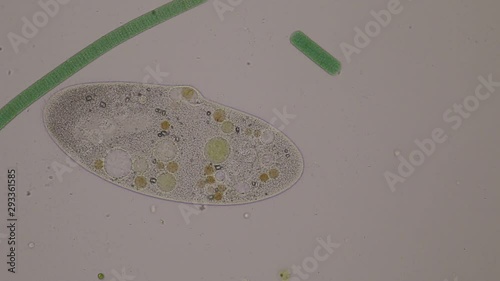 Frontonia sp. is a genus of free-living unicellular ciliate protists under the microscope. photo