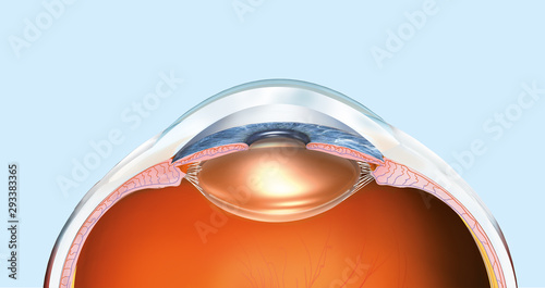 Human eye with artificial lens, labeled, medically 3D illustration